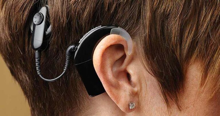 Cochlear-image Cochlear-image