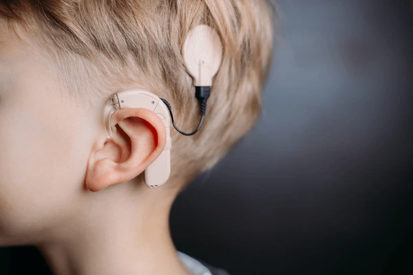 cochlear-implant-on-head-hearing-600nw-1657967119 cochlear-implant-on-head-hearing-600nw-1657967119
