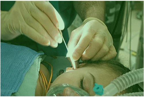 ent-surgery-500x500 ent-surgery-500x500